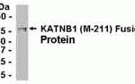 E coli-derived fusion protein as test antigen. Affinity-purified IgY dilution: 1:2000, Goat anti-IgY-HRP dilution: 1:1000. Colorimetric method for signal development.