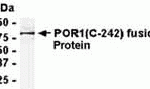 E coli-derived fusion protein as test antigen. Affinity-purified IgY dilution: 1:2000, Goat anti-IgY-HRP dilution: 1:1000. Colorimetric method for signal development.