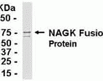 E coli-derived fusion protein as test antigen. Affinity-purified IgY dilution: 1:2000, Goat anti-IgY-HRP dilution: 1:1000. Colorimetric method for signal development.
