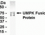 E coli-derived fusion protein as test antigen. Affinity-purified IgY dilution: 1:2000, Goat anti-IgY-HRP dilution: 1:1000. Colorimetric method for signal development.