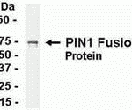 E coli-derived fusion protein as test antigen. Affinity-purified IgY dilution: 1:2000, Goat anti-IgY-HRP dilution: 1:1000. Colorimetric method for signal development.