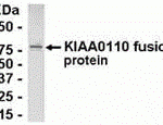 E coli-derived fusion protein as test antigen. Affinity-purified IgY dilution: 1:2000, Goat anti-IgY-HRP dilution: 1:1000. Colorimetric method for signal development.