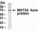 E coli-derived fusion protein as test antigen. Affinity-purified IgY dilution: 1:2000, Goat anti-IgY-HRP dilution: 1:1000. Colorimetric method for signal development.
