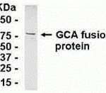 E coli-derived fusion protein as test antigen. Affinity-purified IgY dilution: 1:2000, Goat anti-IgY-HRP dilution: 1:1000. Colorimetric method for signal development.
