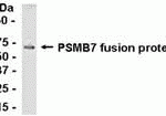 E coli-derived fusion protein as test antigen. Affinity-purified IgY dilution: 1:2000, Goat anti-IgY-HRP dilution: 1:1000. Colorimetric method for signal development.