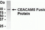 E coli-derived fusion protein as test antigen. Affinity-purified IgY dilution: 1:2000, Goat anti-IgY-HRP dilution: 1:1000. Colorimetric method for signal development.