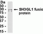 E coli-derived fusion protein as test antigen. Affinity-purified IgY dilution: 1:2000, Goat anti-IgY-HRP dilution: 1:1000. Colorimetric method for signal development.