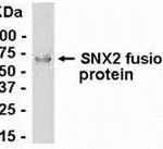 E coli-derived fusion protein as test antigen. Affinity-purified IgY dilution: 1:2000, Goat anti-IgY-HRP dilution: 1:1000. Colorimetric method for signal development.