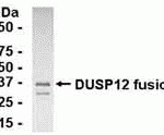 E coli-derived fusion protein as test antigen. Affinity-purified IgY dilution: 1:2000, Goat anti-IgY-HRP dilution: 1:1000. Colorimetric method for signal development.