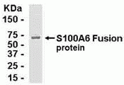 S100A6 Antibody