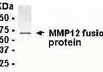 E coli-derived fusion protein as test antigen. Affi-pure IgY dilution: 1:2000, Goat anti-IgY-HRP dilution: 1:1000. Colorimetric method for signal development