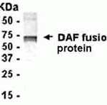 E coli-derived fusion protein as test antigen. Affi-pure IgY dilution: 1:2000, Goat anti-IgY-HRP dilution: 1:1000. Colorimetric method for signal development