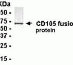 E coli-derived fusion protein as test antigen. Affi-pure IgY dilution: 1:2000, Goat anti-IgY-HRP dilution: 1:1000. Colorimetric method for signal development.
