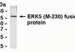 E coli-derived fusion protein as test antigen. Affi-pure IgY dilution: 1:2000, Goat anti-IgY-HRP dilution: 1:1000. Colorimetric method for signal development.