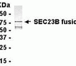 E coli-derived fusion protein as test antigen. Affinity-purified IgY dilution: 1:2000, Goat anti-IgY-HRP dilution: 1:1000. Colorimetric method for signal development.