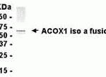 E coli-derived fusion protein as test antigen. Affinity-purified IgY dilution: 1:2000, Goat anti-IgY-HRP dilution: 1:1000. Colorimetric method for signal development.