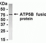 E coli-derived fusion protein as test antigen. Affinity-purified IgY dilution: 1:2000, Goat anti-IgY-HRP dilution: 1:1000. Colorimetric method for signal development.