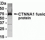 E coli-derived fusion protein as test antigen. Affinity-purified IgY dilution: 1:2000, Goat anti-IgY-HRP dilution: 1:1000. Colorimetric method for signal development.