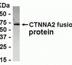 E coli-derived fusion protein as test antigen. Affinity-purified IgY dilution: 1:2000, Goat anti-IgY-HRP dilution: 1:1000. Colorimetric method for signal development.