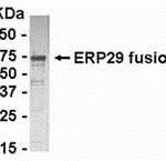 E coli-derived fusion protein as test antigen. Affinity-purified IgY dilution: 1:2000, Goat anti-IgY-HRP dilution: 1:1000. Colorimetric method for signal development.