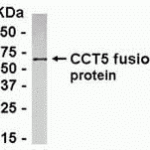 E coli-derived fusion protein as test antigen. Affinity-purified IgY dilution: 1:2000, Goat anti-IgY-HRP dilution: 1:1000. Colorimetric method for signal development.