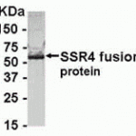 E coli-derived fusion protein as test antigen. Affinity-purified IgY dilution: 1:2000, Goat anti-IgY-HRP dilution: 1:1000. Colorimetric method for signal development.