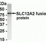 E coli-derived fusion protein as test antigen. Affinity-purified IgY dilution: 1:2000, Goat anti-IgY-HRP dilution: 1:1000. Colorimetric method for signal development.