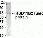 E coli-derived fusion protein as test antigen. Affinity-purified IgY dilution: 1:2000, Goat anti-IgY-HRP dilution: 1:1000. Colorimetric method for signal development.