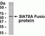 E coli-derived fusion protein as test antigen. Affinity-purified IgY dilution: 1:2000, Goat anti-IgY-HRP dilution: 1:1000. Colorimetric method for signal development.