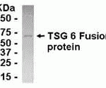 E coli-derived fusion protein as test antigen. Affinity-purified IgY dilution: 1:2000, Goat anti-IgY-HRP dilution: 1:1000. Colorimetric method for signal development.