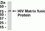 E coli-derived fusion protein as test antigen. Affinity-purified IgY dilution: 1:2000, Goat anti-IgY-HRP dilution: 1:1000. Colorimetric method for signal development.
