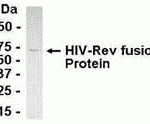 E coli-derived fusion protein as test antigen. Affinity-purified IgY dilution: 1:2000, Goat anti-IgY-HRP dilution: 1:1000. Colorimetric method for signal development.