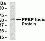 E coli-derived fusion protein as test antigen. Affinity-purified IgY dilution: 1:2000, Goat anti-IgY-HRP dilution: 1:1000. Colorimetric method for signal development.