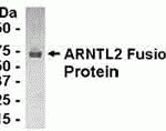 E coli-derived fusion protein as test antigen. Affinity-purified IgY dilution: 1:2000, Goat anti-IgY-HRP dilution: 1:1000. Colorimetric method for signal development.