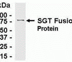 E coli-derived fusion protein as test antigen. Affinity-purified IgY dilution: 1:2000, Goat anti-IgY-HRP dilution: 1:1000. Colorimetric method for signal development.