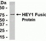 E coli-derived fusion protein as test antigen. Affinity-purified IgY dilution: 1:2000, Goat anti-IgY-HRP dilution: 1:1000. Colorimetric method for signal development.
