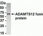 E coli-derived fusion protein as test antigen. Affinity-purified IgY dilution: 1:2000, Goat anti-IgY-HRP dilution: 1:1000. Colorimetric method for signal development.