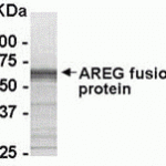 E coli-derived fusion protein as test antigen. Affinity-purified IgY dilution: 1:2000, Goat anti-IgY-HRP dilution: 1:1000. Colorimetric method for signal development.