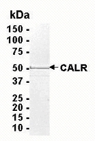 CALR Recombinant Protein