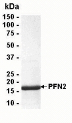 PFN2 Recombinant Protein