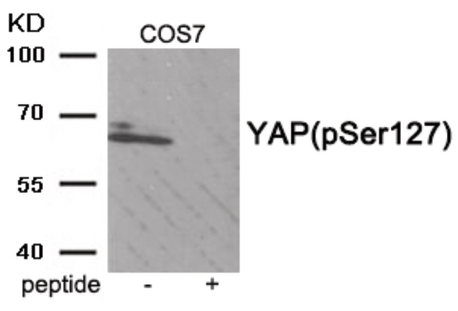 YAP (phospho Ser127) Antibody