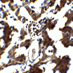 Immunohistochemistry of ZEB1 in human liver tissue with ZEB1 antibody at 5 μg/mL.