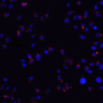 Immunofluorescence of ZEB2 in Jurkat cells with ZEB2 antibody at 20 μg/ml.<br><br>Red: ZEB2 Antibody (5827) <br> Blue: DAPI staining