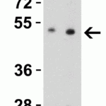 <strong>Figure 4 Western Blot Validation in Mouse Brain Tissue Lysate</strong><br>Loading: 15 μg of lysates per lane.Antibodies: ZIP7, 6093 (Lane 1: 0.5 μg/mL and Lane 2: 1 μg/mL), 1h incubation at RT in 5% NFDM/TBST.Secondary: Goat anti-rabbit IgG HRP conjugate at 1:10000 dilution.