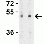 <strong>Figure 5 Western Blot Validation in Rat Brain Tissue Lysate</strong><br>Loading: 15 μg of lysates per lane.Antibodies: ZIP7, 6093 (Lane 1: 0.5 μg/mL and Lane 2: 1 μg/mL), 1h incubation at RT in 5% NFDM/TBST.Secondary: Goat anti-rabbit IgG HRP conjugate at 1:10000 dilution.