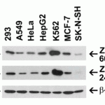 <strong>Figure 2 Independent Antibody Validation (IAV) via Protein Expression Profile in Human Cell Lines</strong><br>Loading: 15 μg of lysates per lane.Antibodies: ZIP7, 6093 (1 μg/mL), ZIP7, 24-029 (4 μg/mL), and beta-actin (1 μg/mL),  1h incubation at RT  in 5% NFDM/TBST.Secondary: Goat anti-rabbit IgG HRP conjugate at 1:10000 dilution.