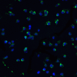 Immunofluorescence of ZIPK in Jurkat cells with ZIPK antibody at 10 μg/mL.