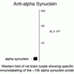 Western blot of rat brain lysate showing specific immunolabeling of the ~15k alpha synuclein protein.