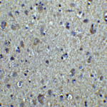 Immunohistochemistry of alpha-Tubulin in human brain tissue with alpha-Tubulin antibody at 2.5 μg/ml.