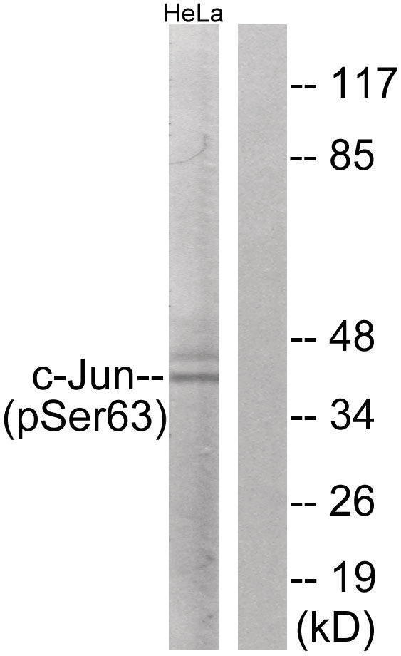 c-Jun (phospho Ser63) Antibody